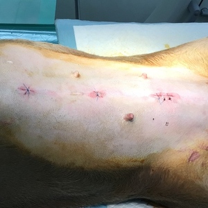 腹腔鏡下避妊手術